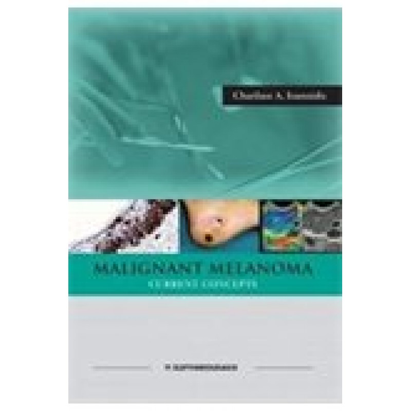 Malignant Melanoma Current Concepts