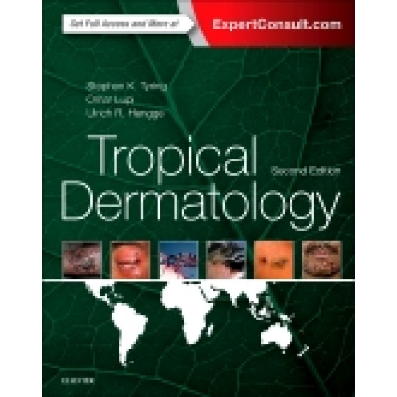 Tropical Dermatology, 2nd Edition