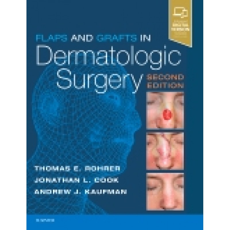 Flaps and Grafts in Dermatologic Surgery, 2nd Edition