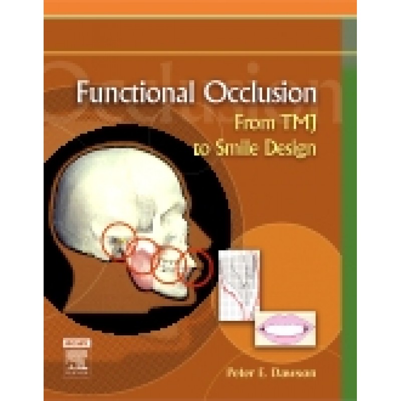 Functional Occlusion