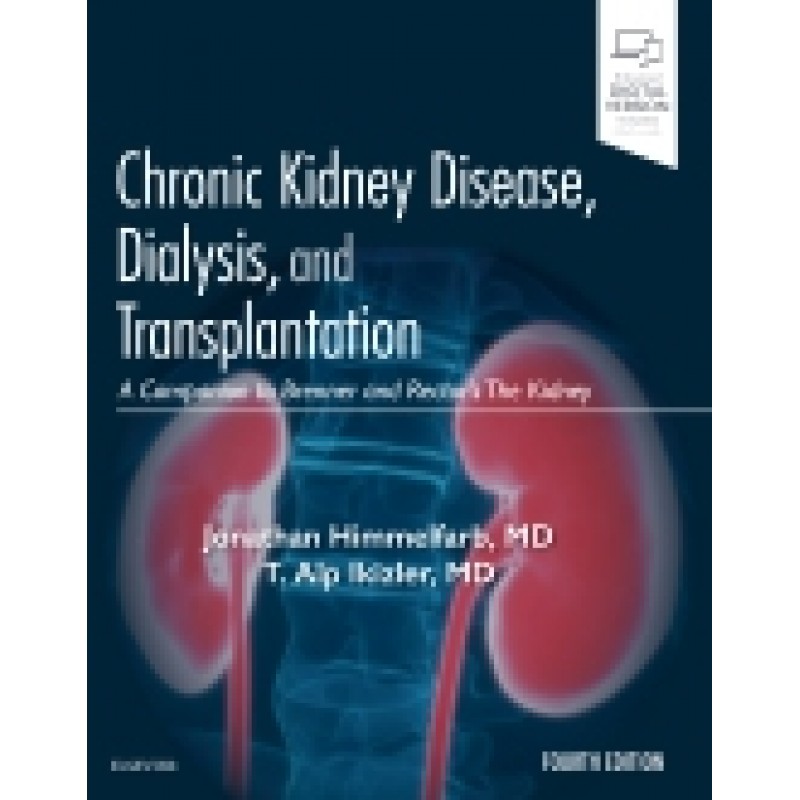 Chronic Kidney Disease, Dialysis, and Transplantation, 4th Edition