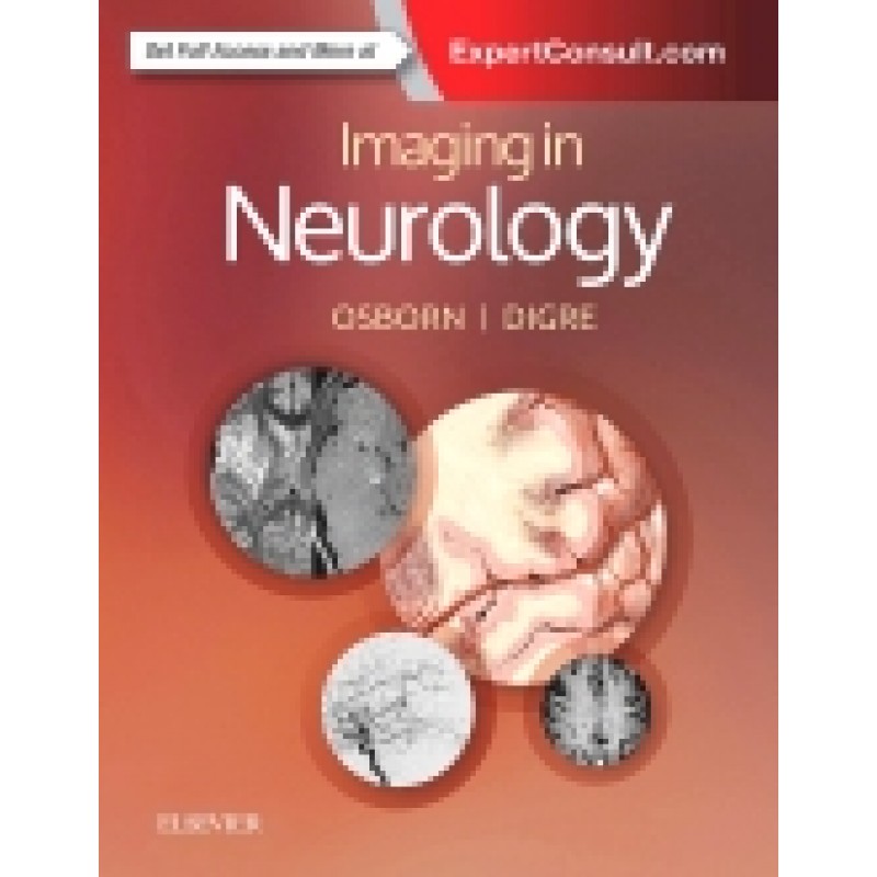 Imaging in Neurology