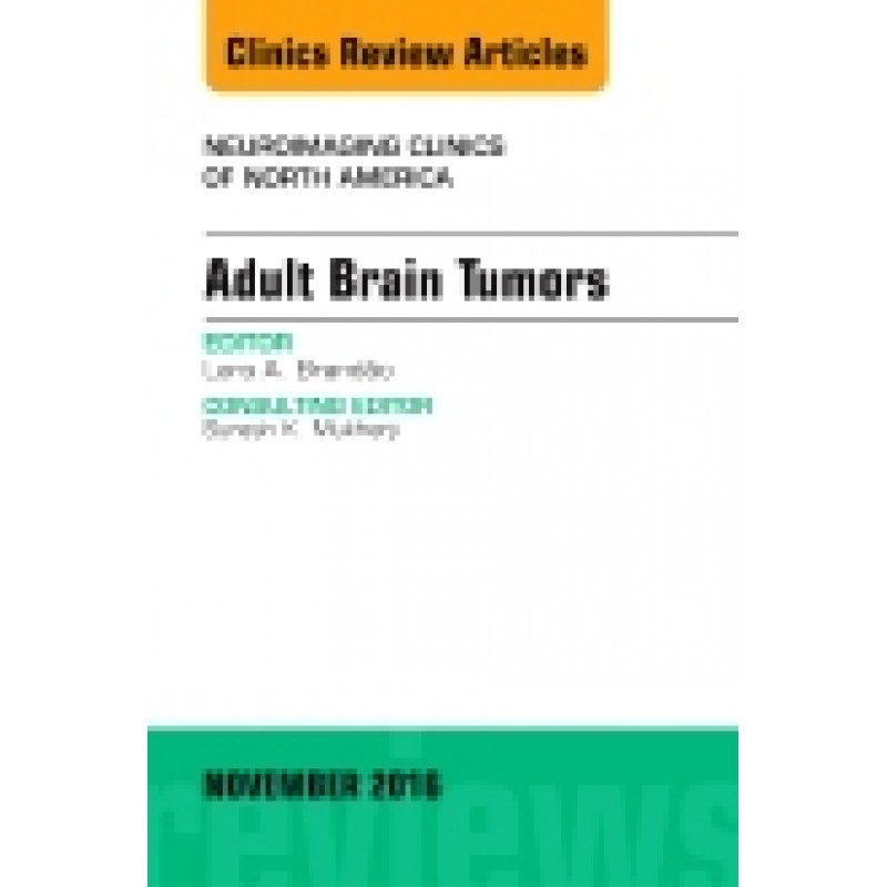 Adult Brain Tumors, An Issue of Neuroimaging Clinics of North America, Volume 26-4