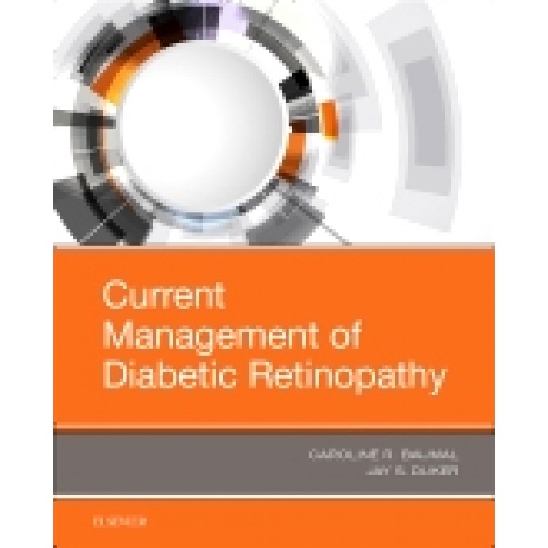 Current Management of Diabetic Retinopathy