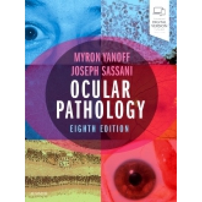 Ocular Pathology, 8th Edition