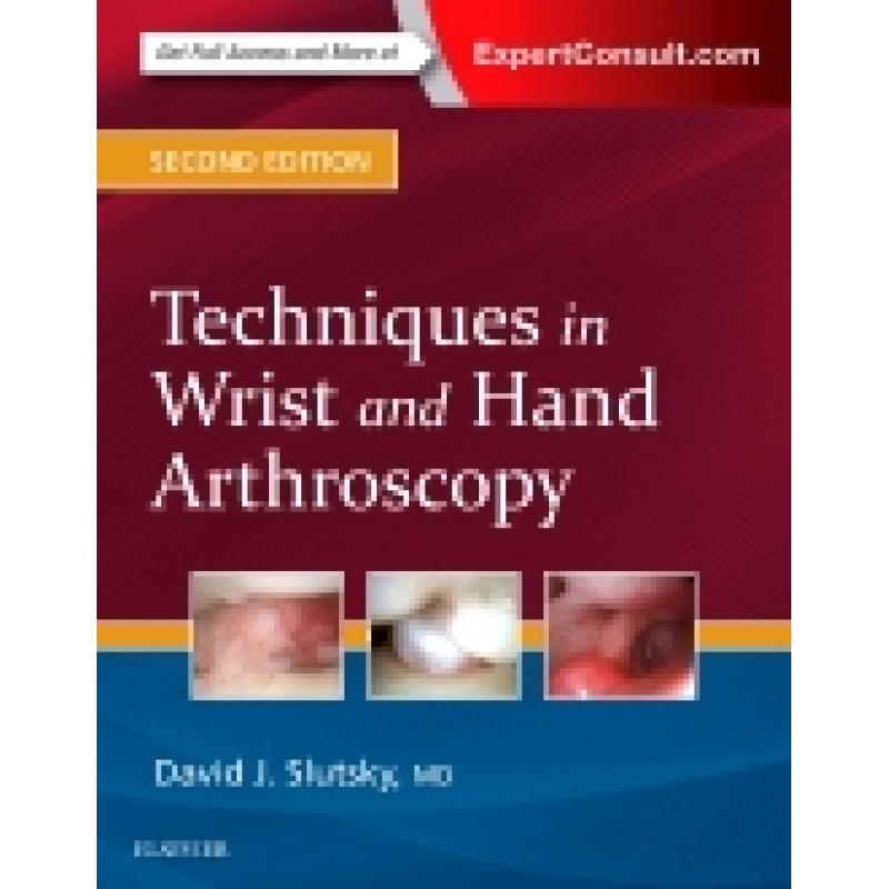 Techniques in Wrist and Hand Arthroscopy, 2nd Edition