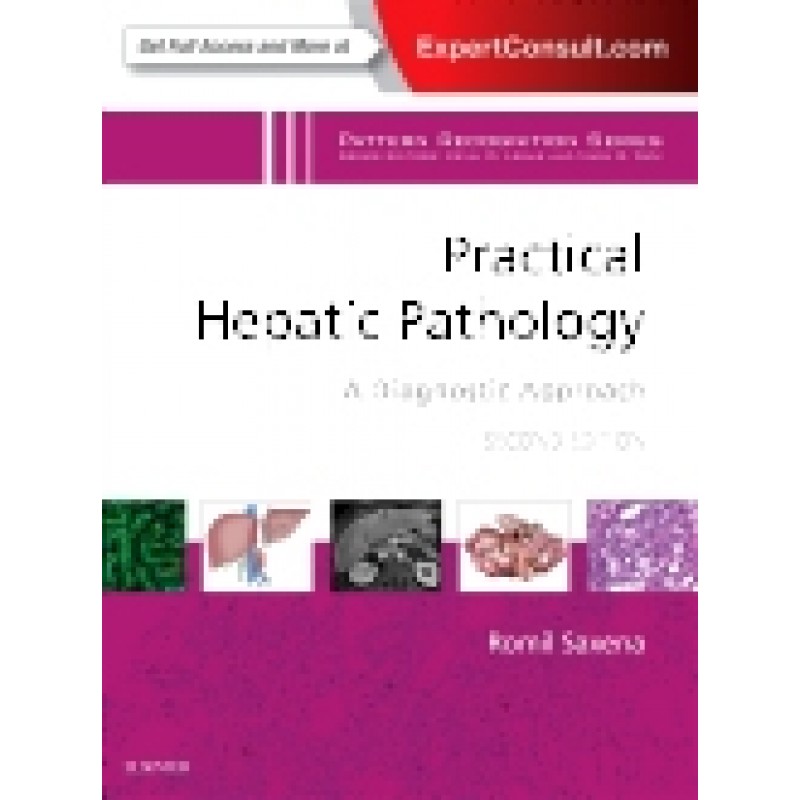 Practical Hepatic Pathology: A Diagnostic Approach, 2nd Edition