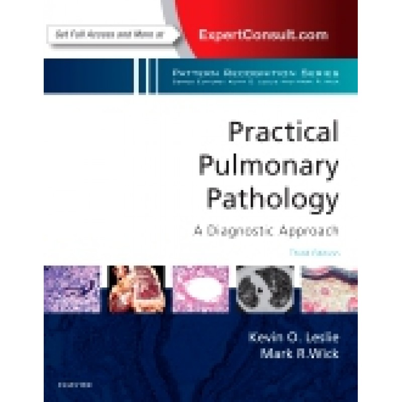 Practical Pulmonary Pathology: A Diagnostic Approach, 3rd Edition