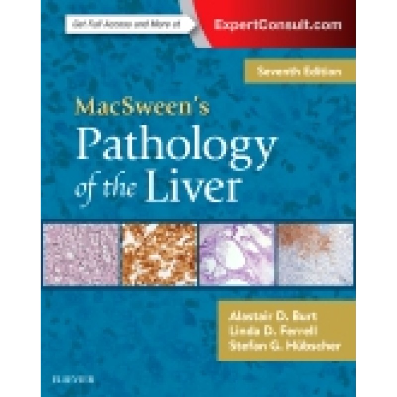 MacSween's Pathology of the Liver, 7th Edition