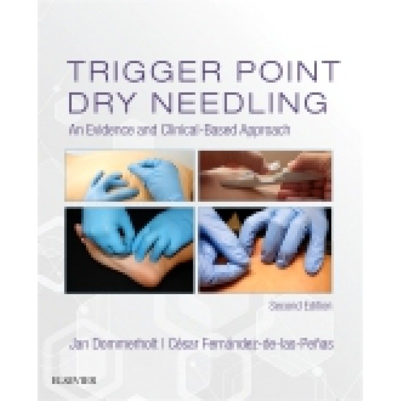 Trigger Point Dry Needling, 2nd Edition