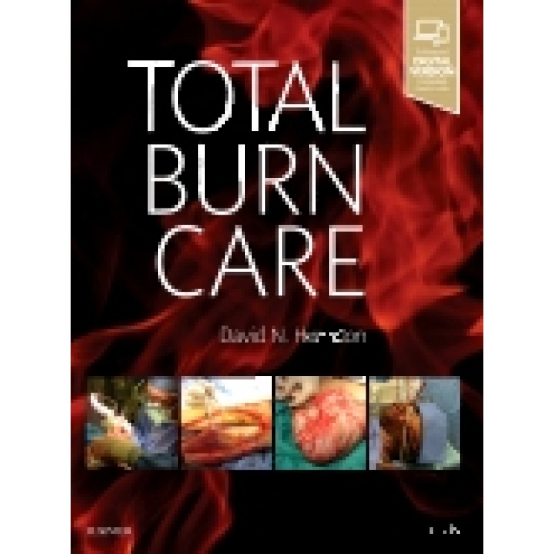 Total Burn Care, 5th Edition