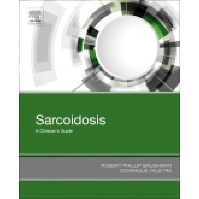 Sarcoidosis