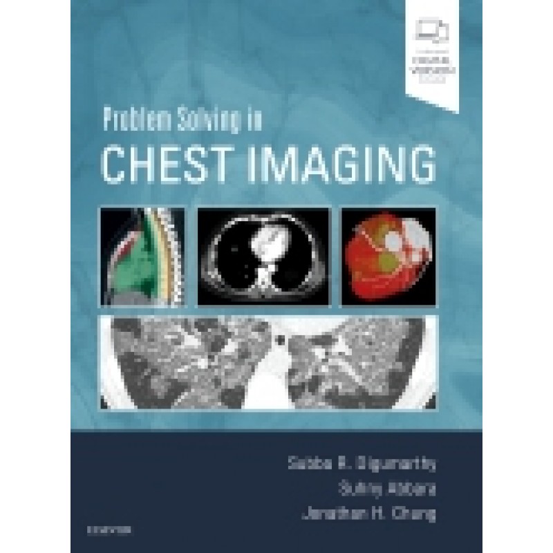 Problem Solving in Chest Imaging