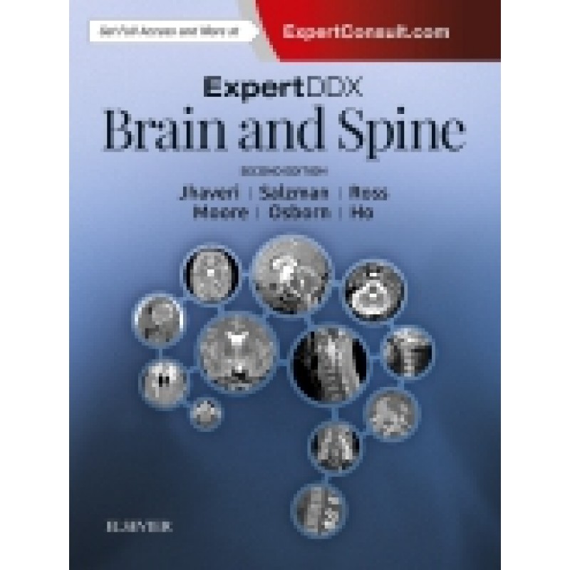 ExpertDDx: Brain and Spine, 2nd Edition