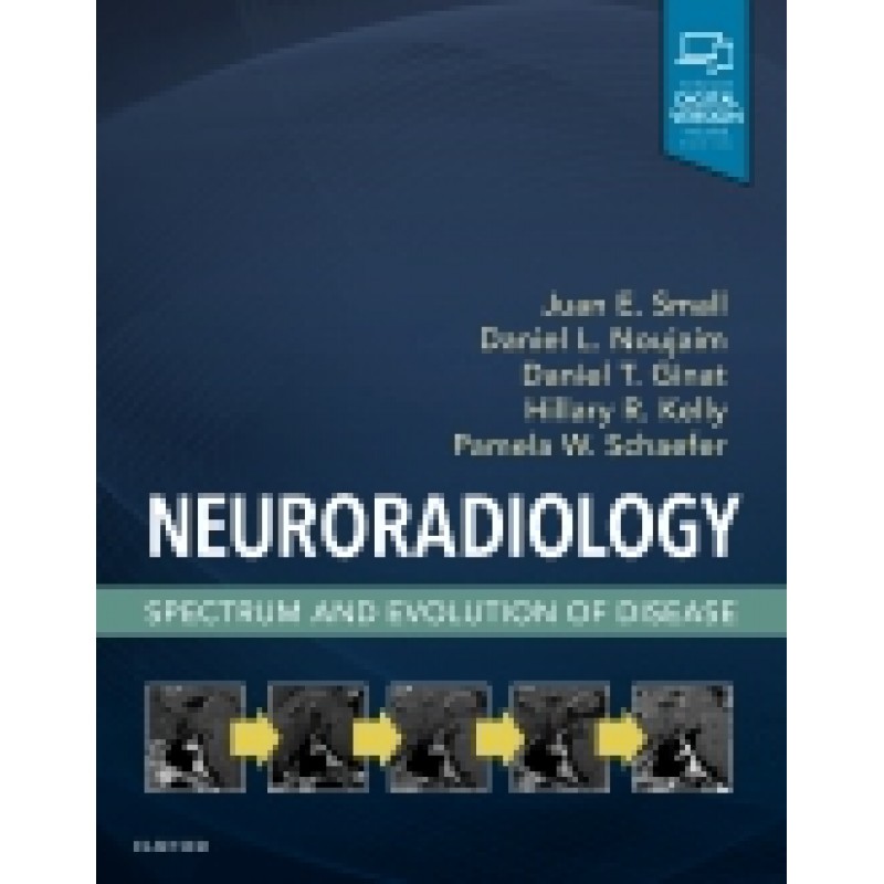 Neuroradiology