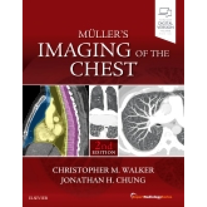 Muller's Imaging of the Chest, 2nd Edition