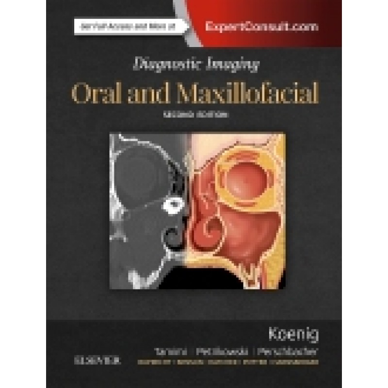 Diagnostic Imaging: Oral and Maxillofacial , 2nd Edition