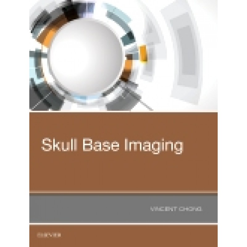 Skull Base Imaging