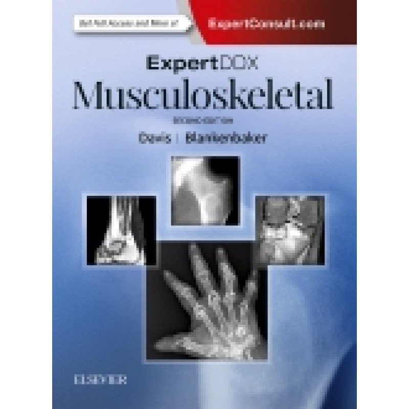 ExpertDDx: Musculoskeletal, 2nd Edition