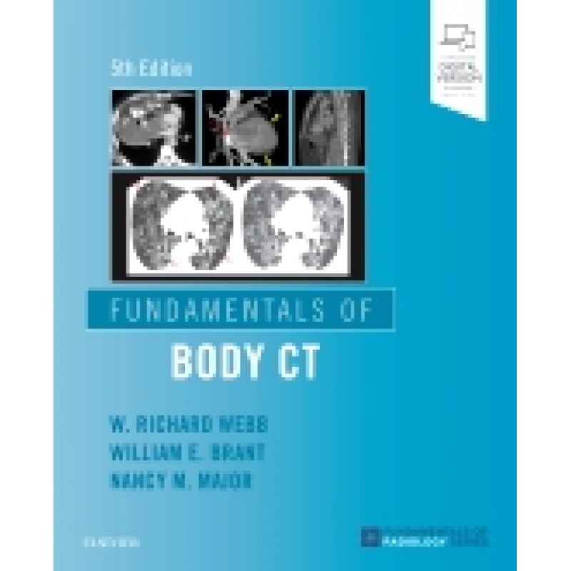 Fundamentals of Body CT, 5th Edition