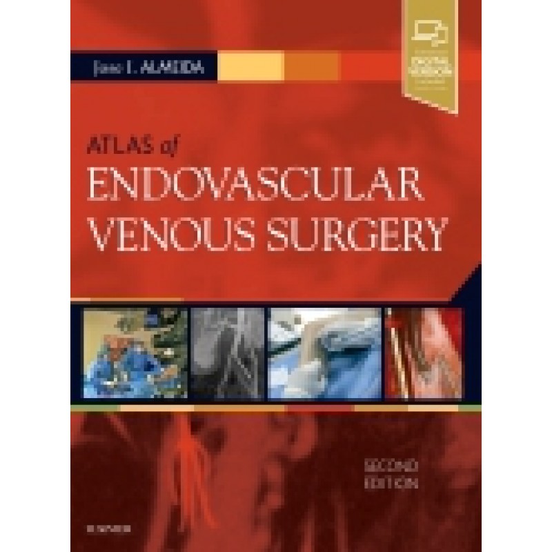 Atlas of Endovascular Venous Surgery, 2nd Edition