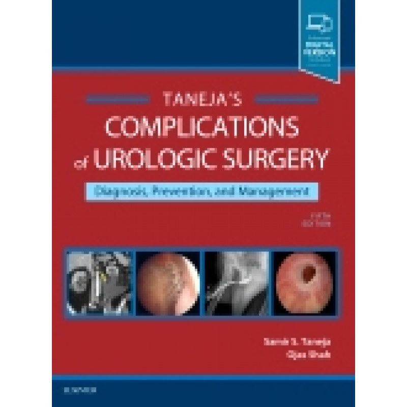 Complications of Urologic Surgery, 5th Edition