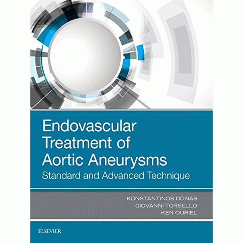 Endovascular Treatment of Aortic Aneurysms: Standard and Advanced Techniques