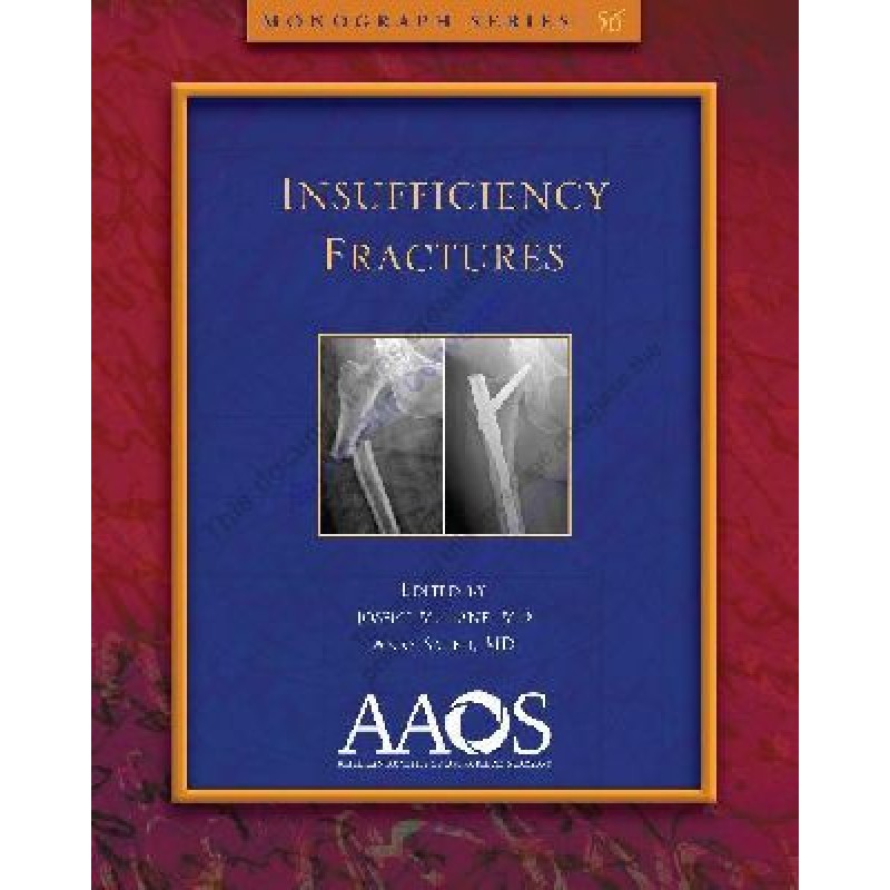 Insufficiency Fractures