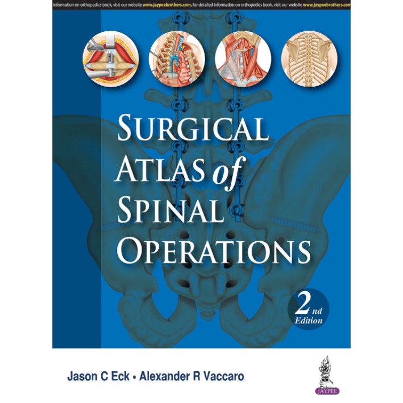 Surgical Atlas of Spinal Operations