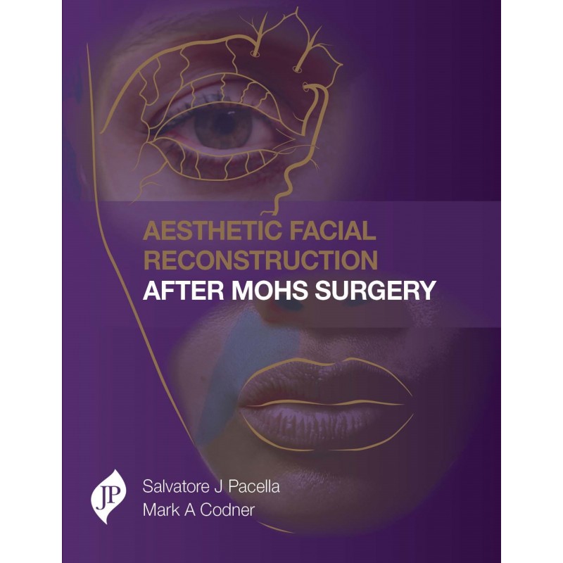 Aesthetic Facial Reconstruction After Mohs Surgery