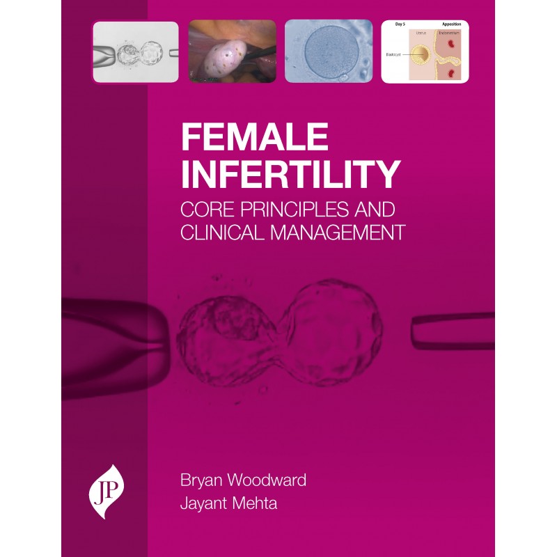 Female Infertility