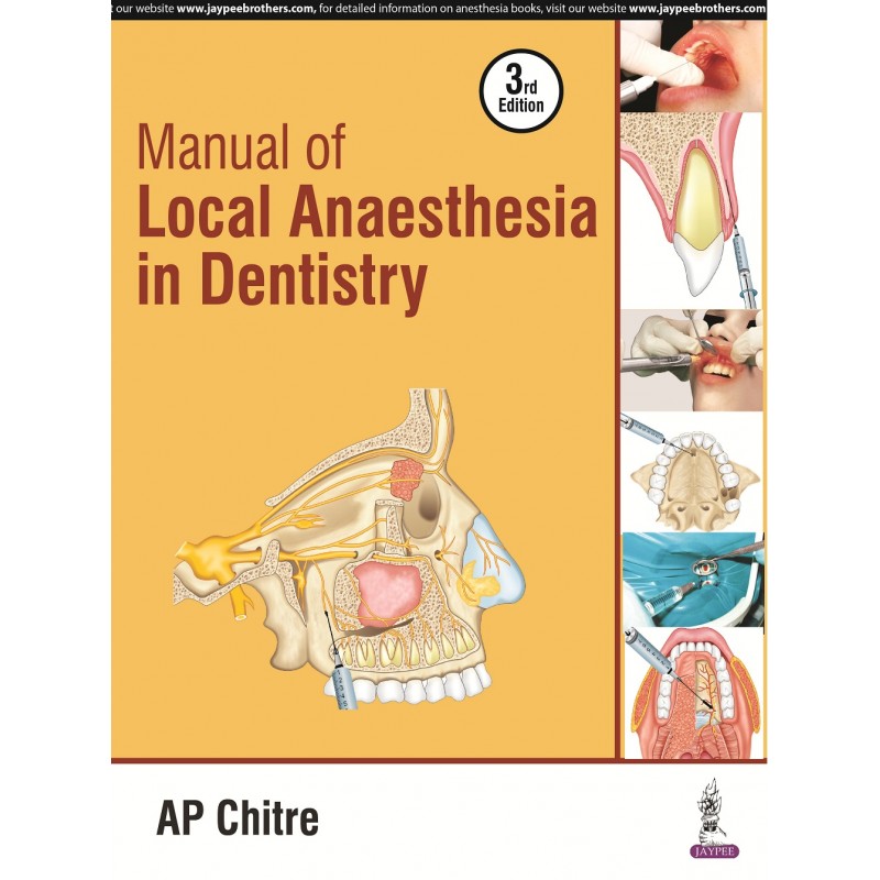 Manual of Local Anaesthesia in Dentistry