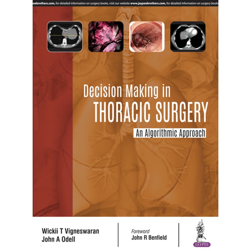 Decision Making in Thoracic Surgery