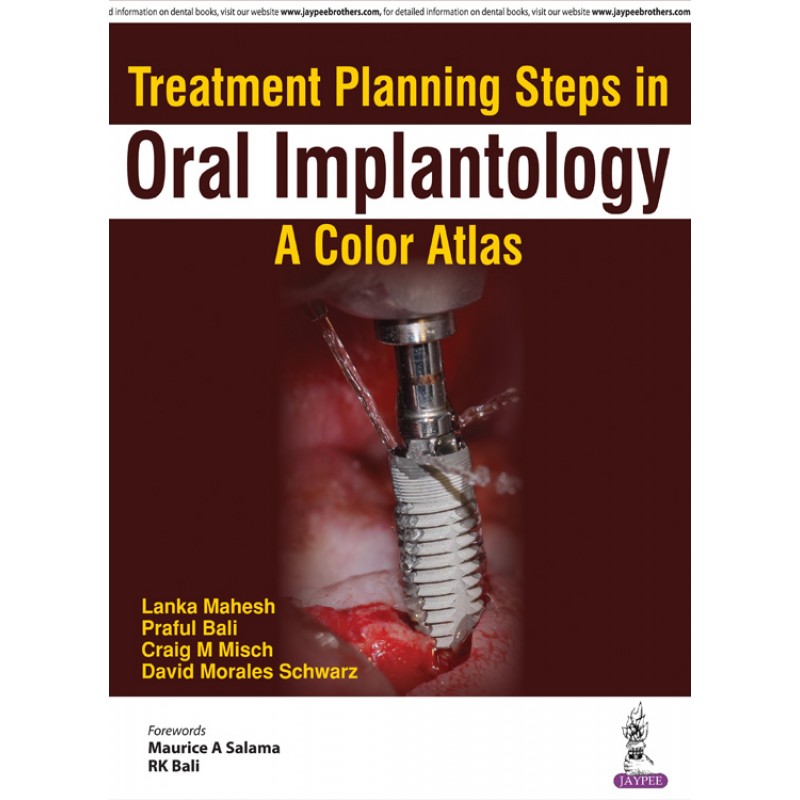 Treatment Planning Steps in Oral Implantology