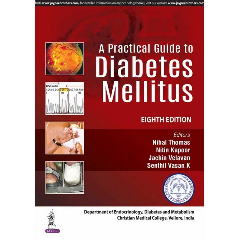 A Practical Guide to Diabetes Mellitus