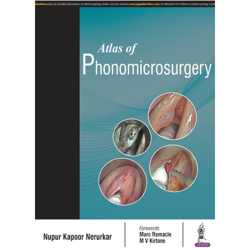 Atlas of Phonomicrosurgery