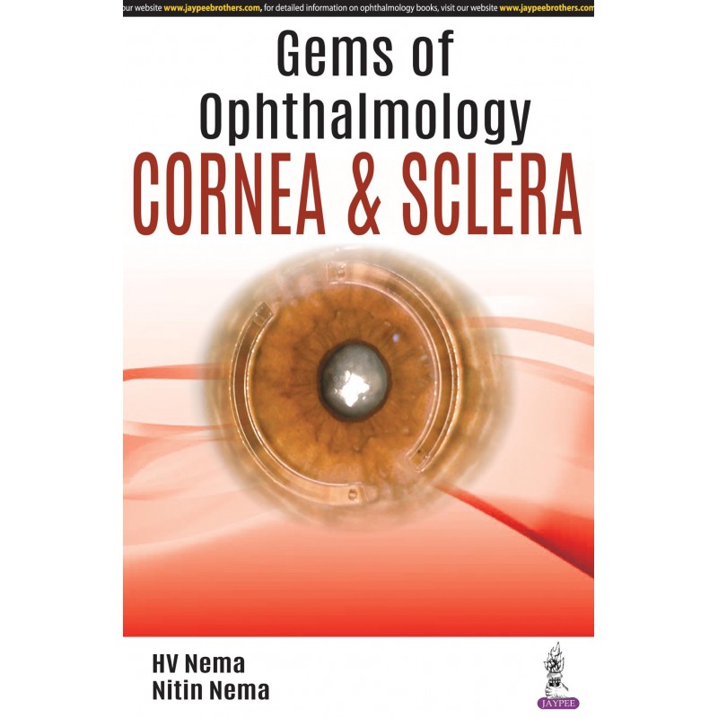 Gems of Ophthalmology: Cornea and Sclera