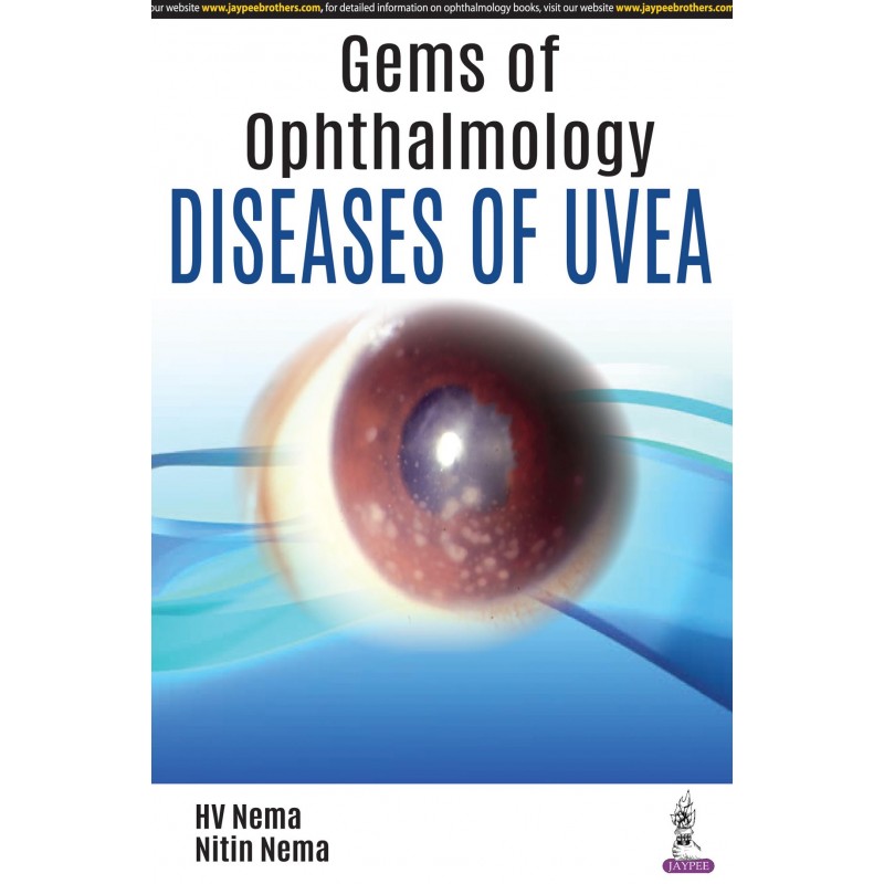 Gems of Ophthalmology: Diseases of Uvea