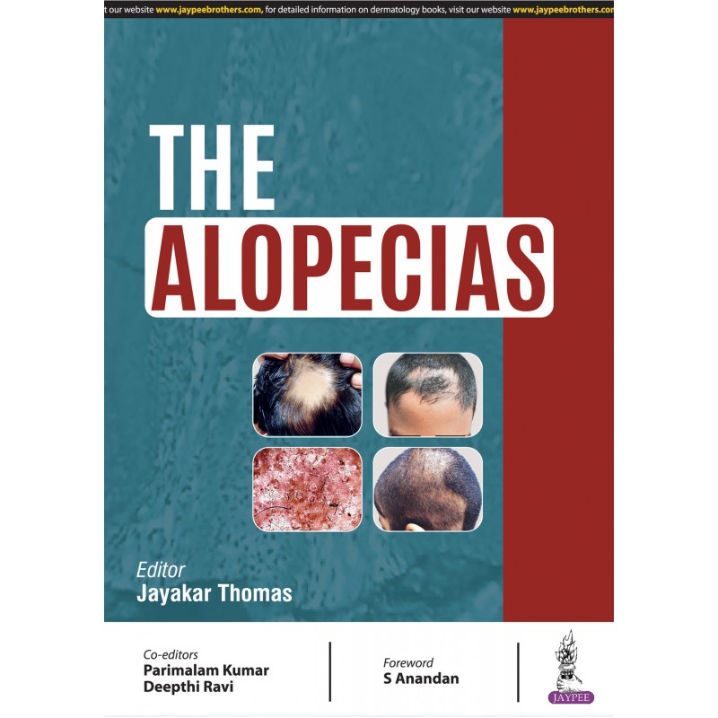 The Alopecias