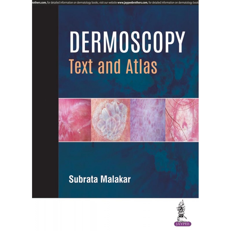 Dermoscopy: Text and Atlas