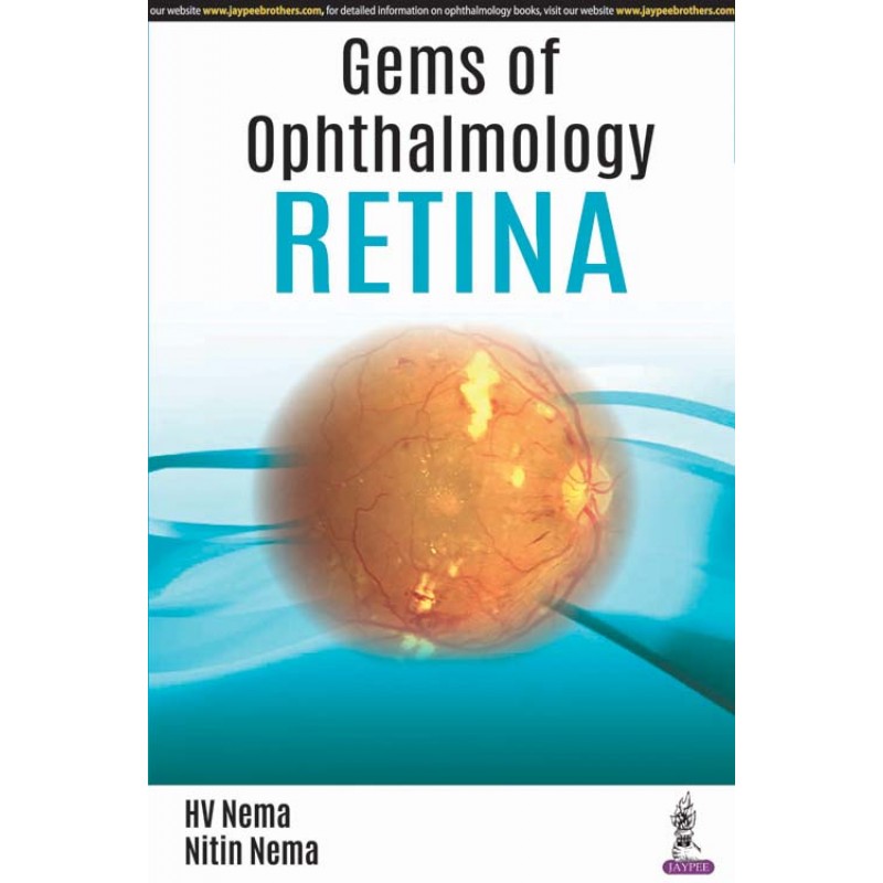 Gems of Ophthalmology: Retina