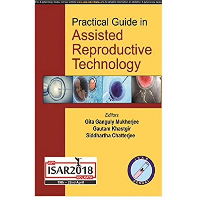 Practical Guide in Assisted Reproductive Technology