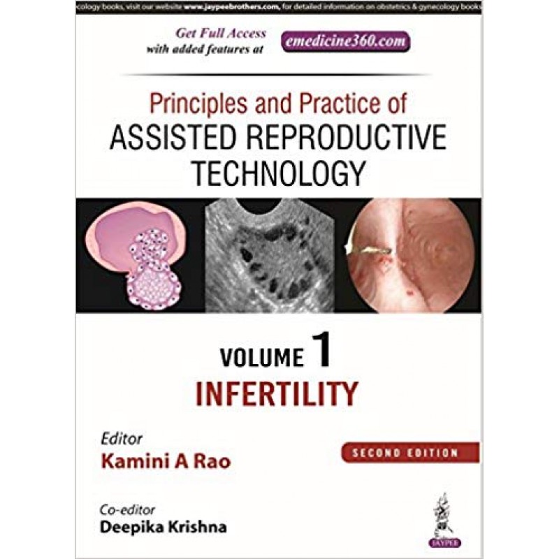 Principles and Practice of Assisted Reproductive Technology: Three Volume Set Revised Edition