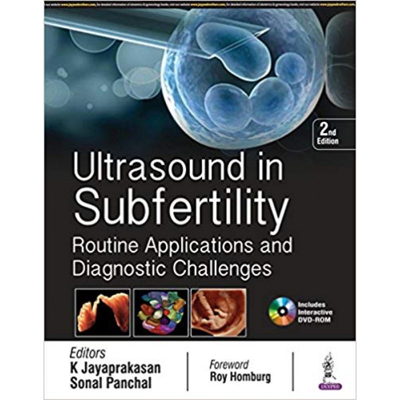 Ultrasound in Subfertility: Routine Applications and Diagnostic Challenges