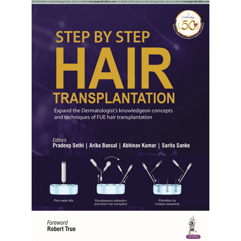 Step by Step Hair Transplantation