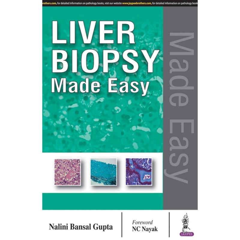 Liver Biopsy Made Easy