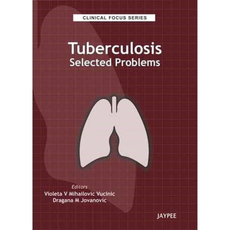 Clinical Focus Series: Tuberculosis