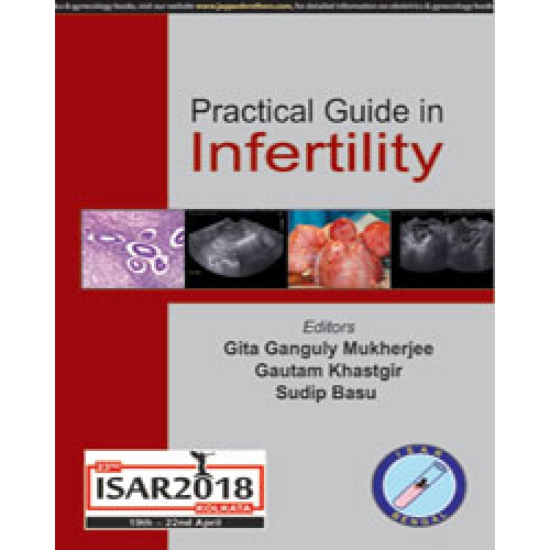 Practical Guide to Infertility