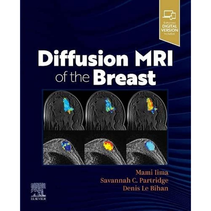 Diffusion MRI of the Breast 