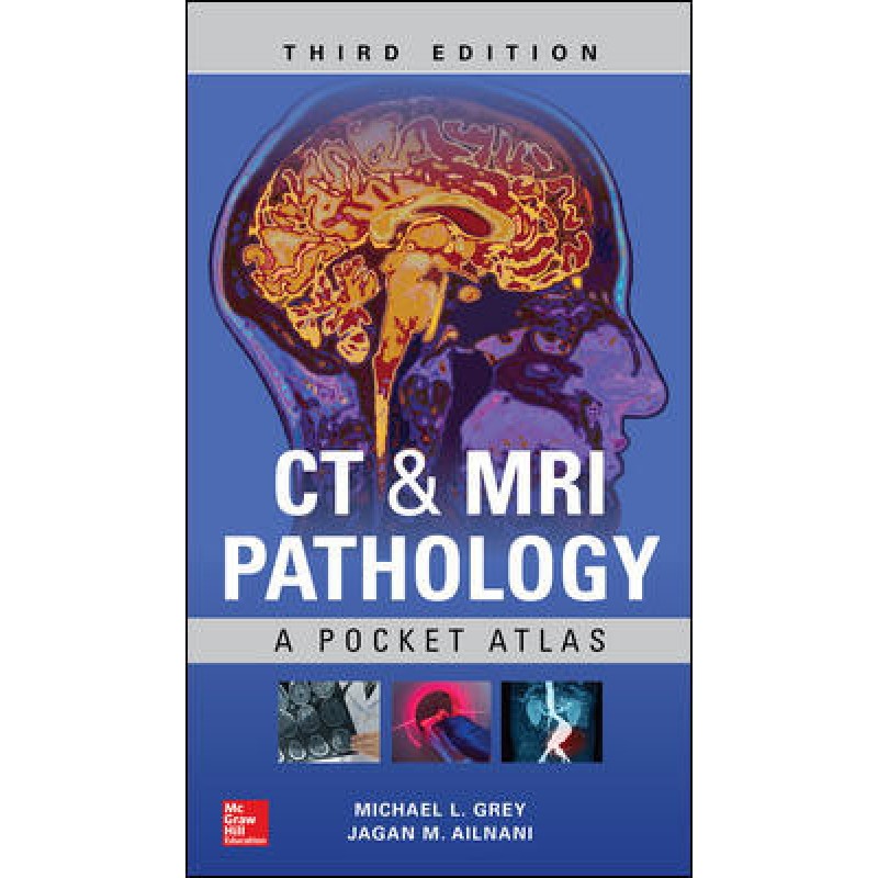 CT and MRI Pathology: A Pocket Atlas, Third Edition